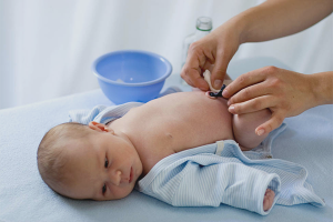 Hoe om te gaan met een navel voor een pasgeboren baby