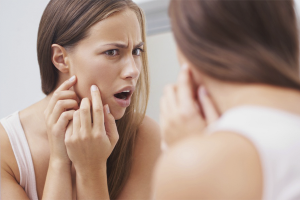 Waarom verschijnt er acne op mijn gezicht?