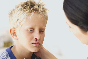 Epistaxis bij kinderen